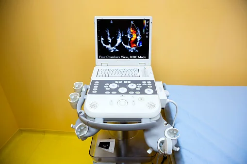 Echocardiography heart ultrasound